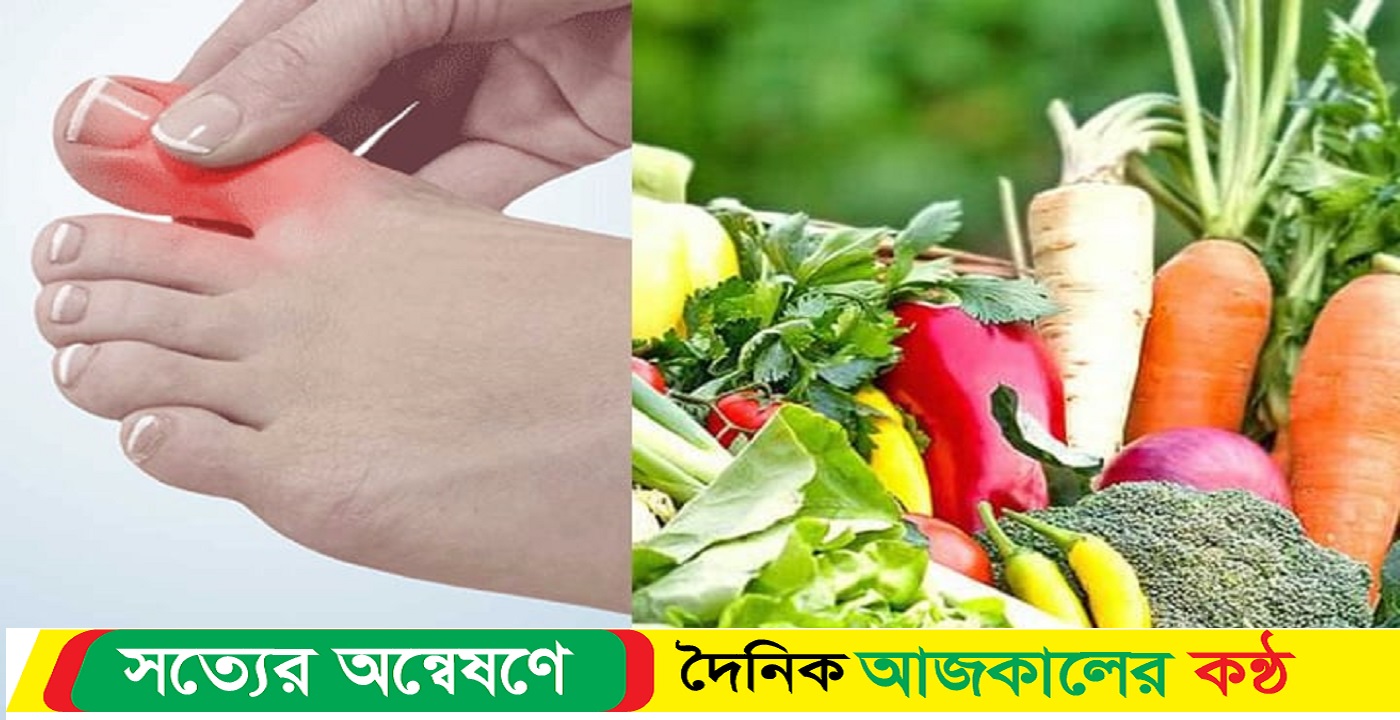 ইউরিক অ্যাসিড নিয়ন্ত্রণে উপকারী যেসব সবজি