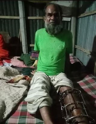 চিকিৎসার অভাবে পঙ্গু দিনমজুর রহমত