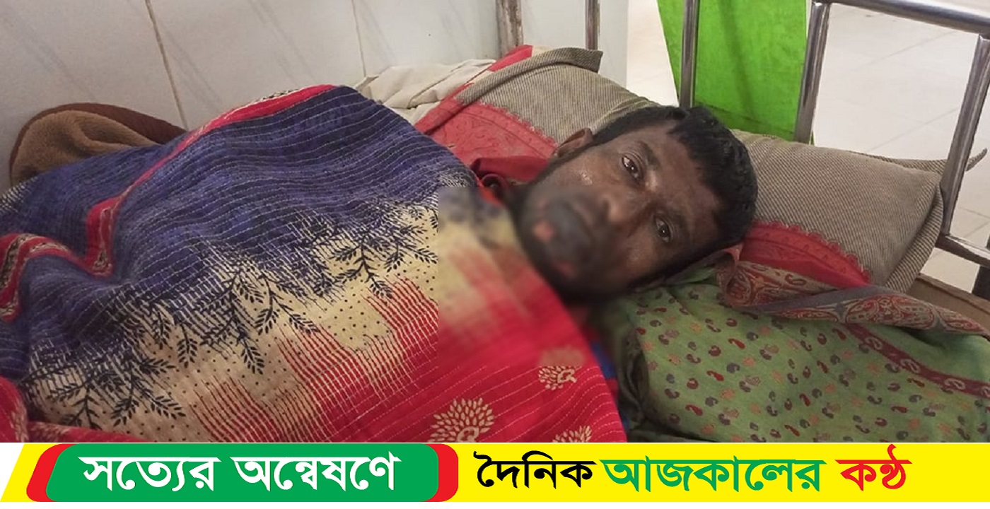 আগুন পোহাতে গিয়ে শ্রমিক দগ্ধ