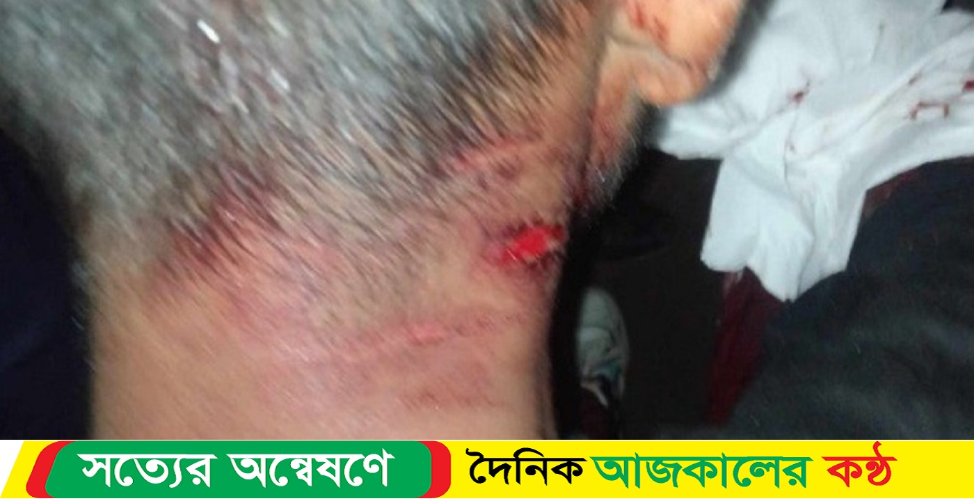 ময়মনসিংহ রেলওয়েতে ছিনতাইকারীর ছুরিকাঘাতে একজন নিহত