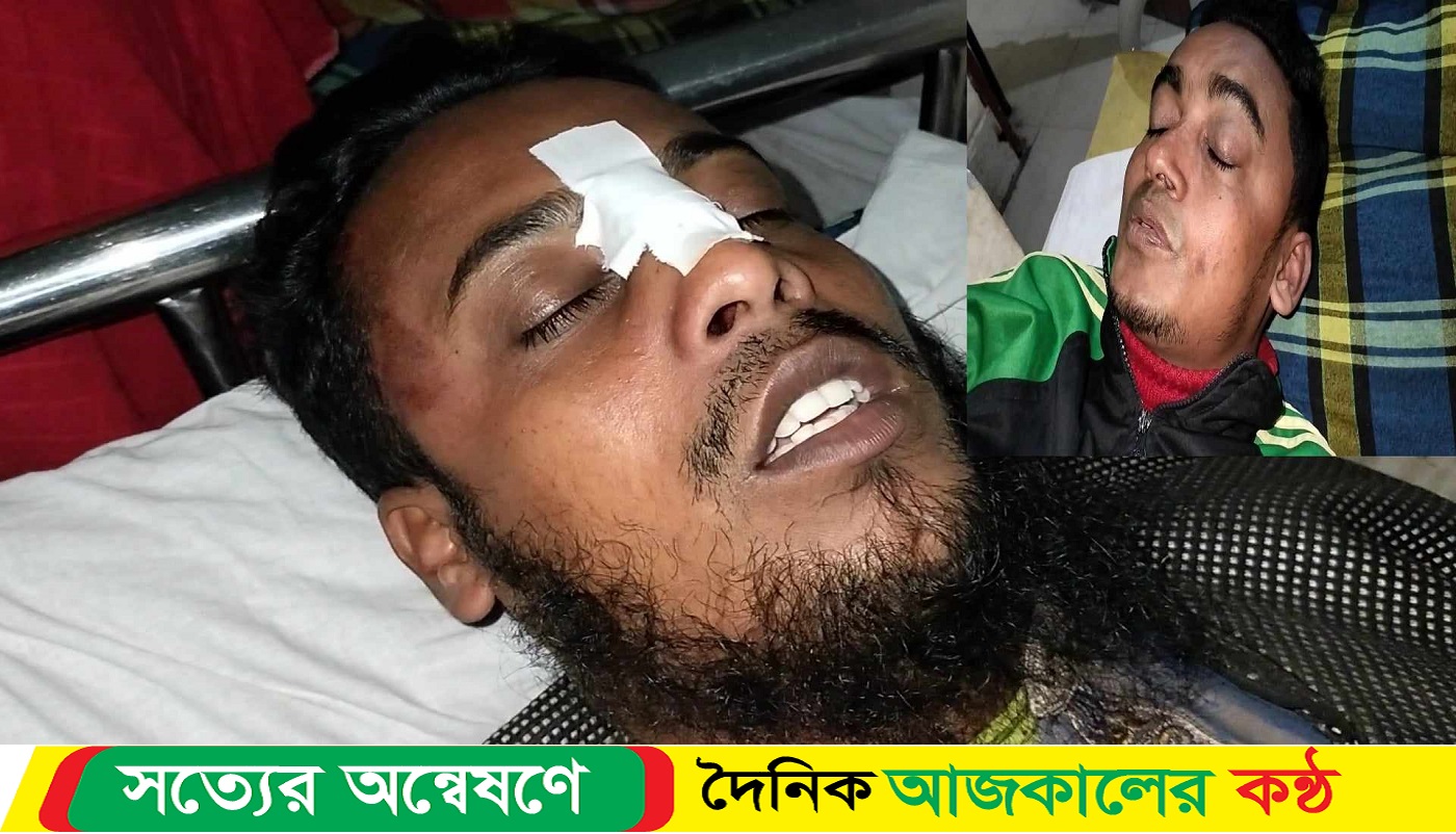 বাউফলে জমিজমার বিরোধের জেরে সাংবাদিকের উপর হামলা