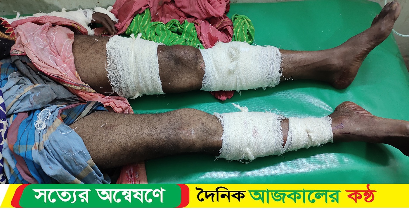 তিতাসে পূর্ব শত্রুতার জের ধরে প্রতিপক্ষের ওপর হামলা আহত ২