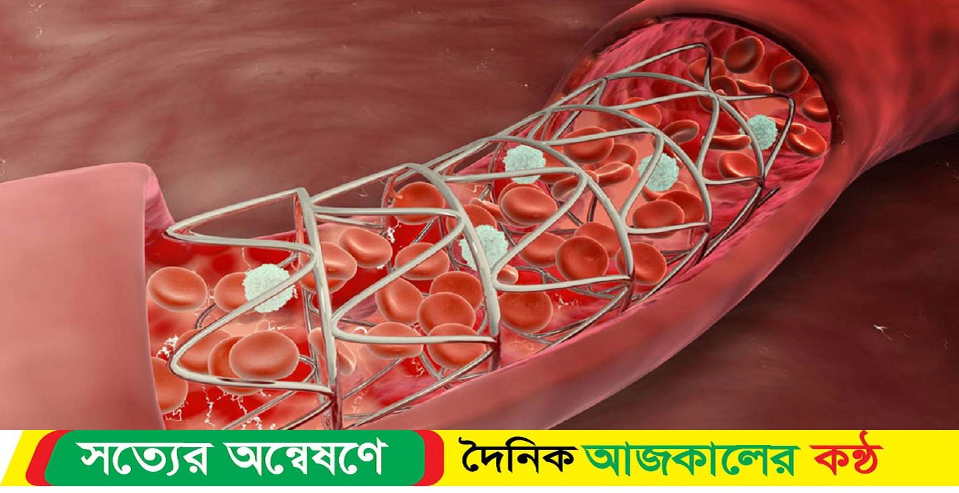 হার্টের রিংয়ের নতুন দাম নির্ধারণ