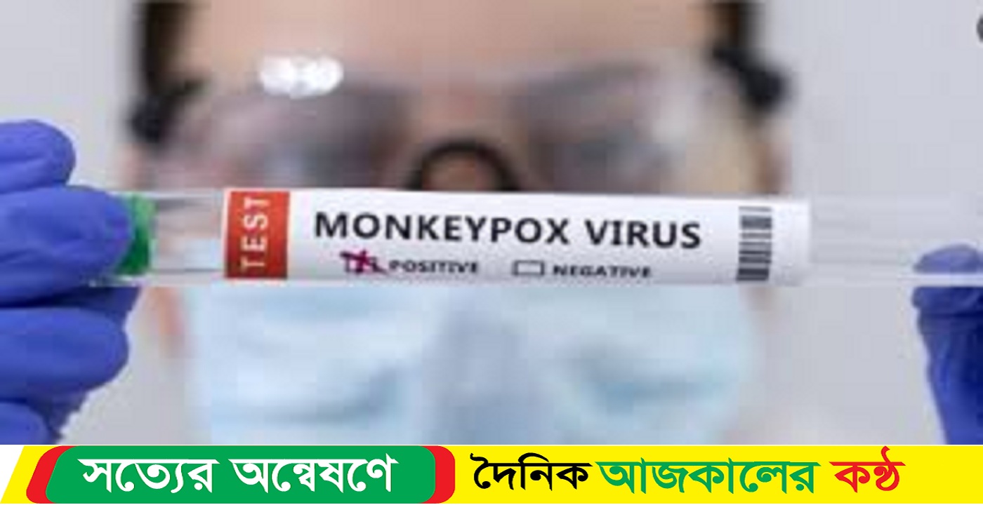 স্বাস্থ্য অধিদপ্তর মাংকি পক্স সচেতনতায় হটলাইন চালু করল