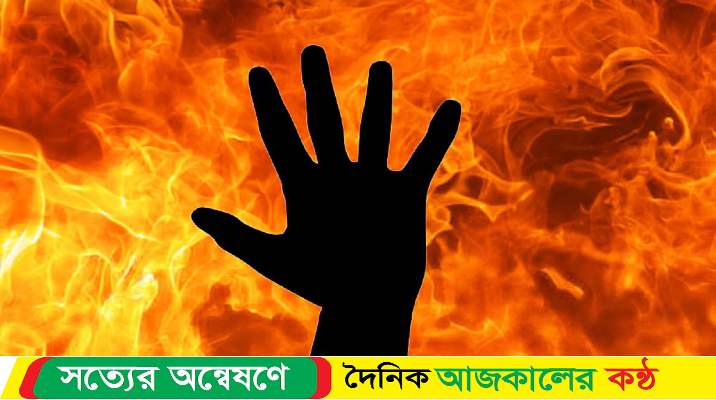 কন্যা সন্তান জন্ম দেয়ায় স্ত্রীকে পুড়িয়ে মারল স্বামী