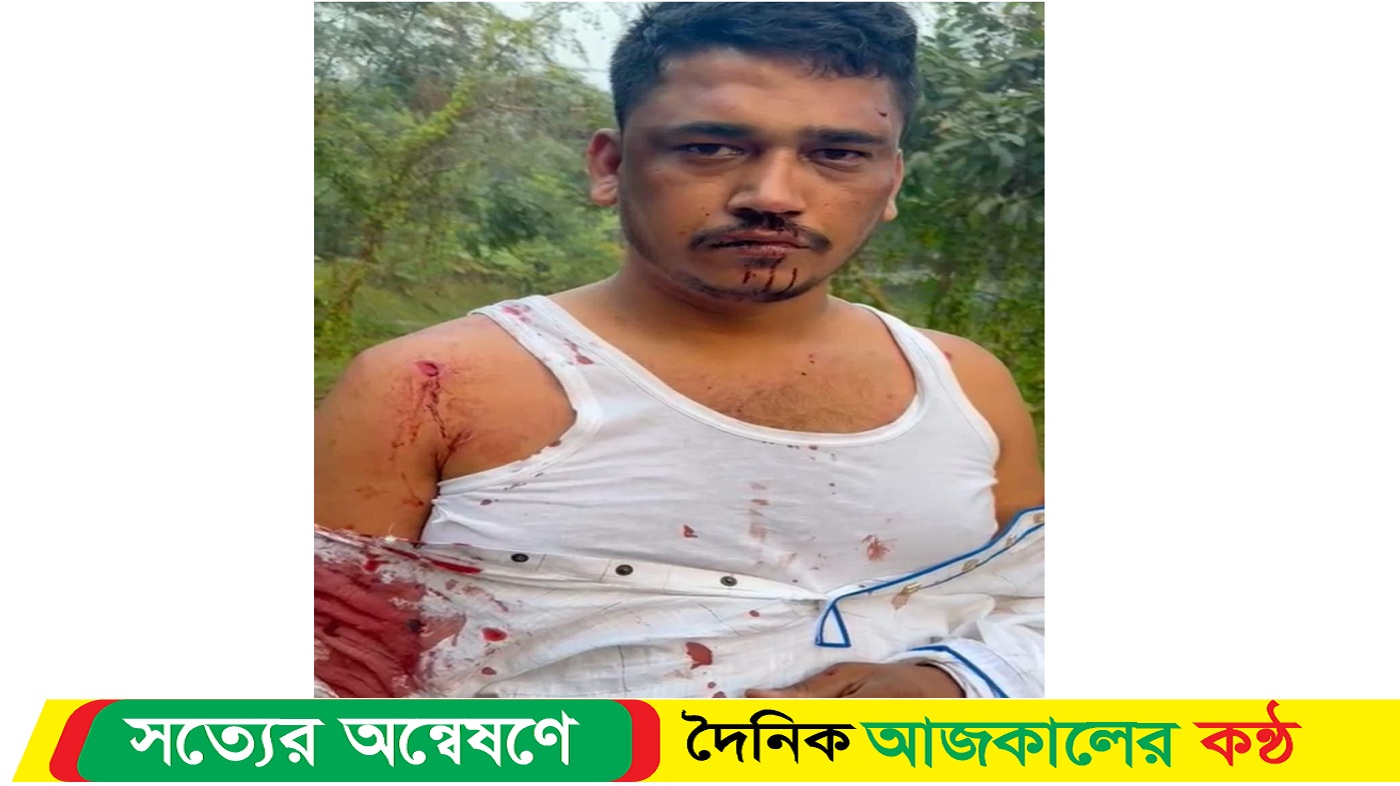 মুরাদনগরে ব্যবসায়ীর উপর সন্ত্রাসী হামলা: গাড়ি ভাঙচুর লুটপাট