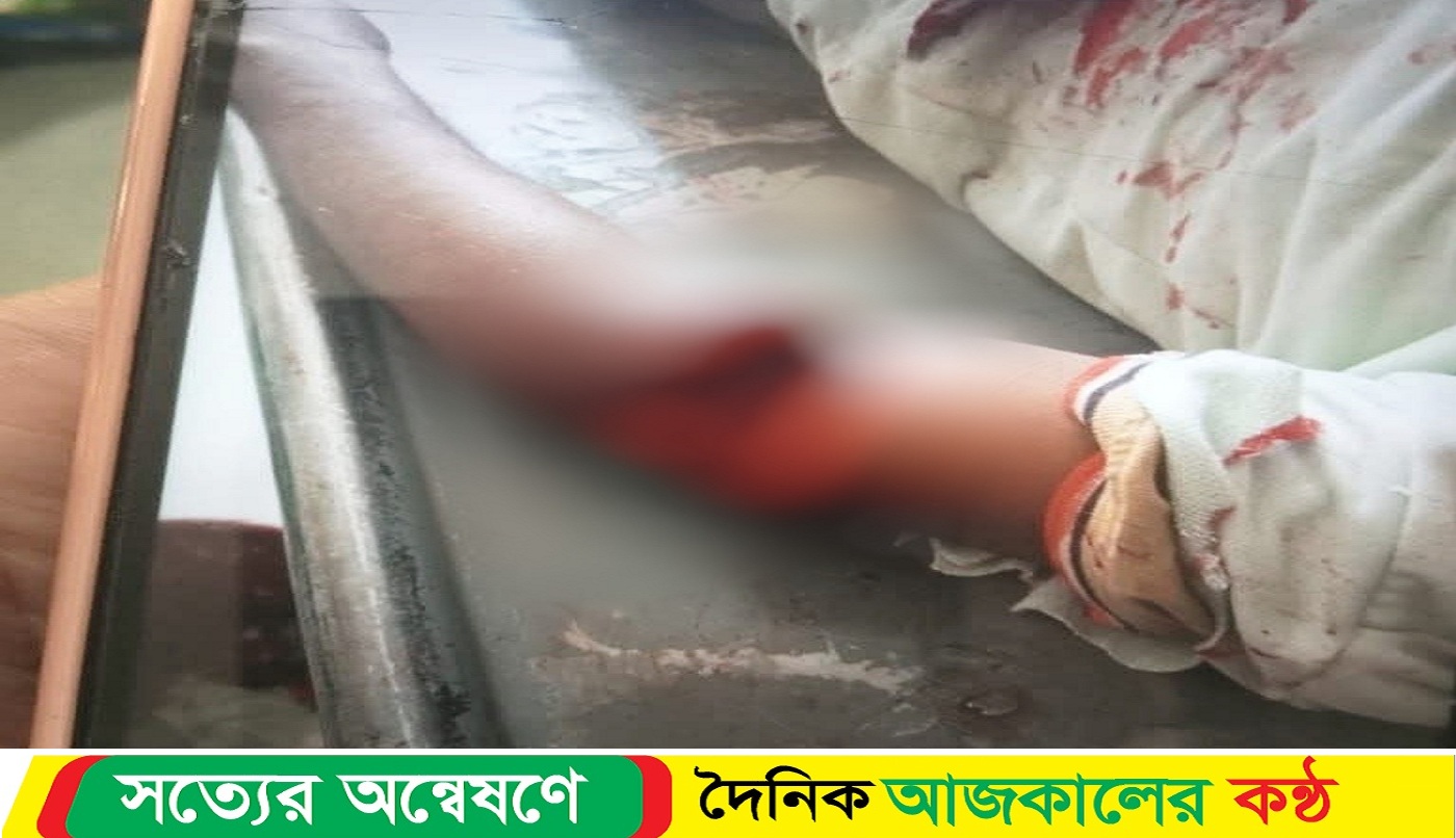 যুবককে কুপিয়ে জখম করার পরেও গ্রেপ্তার হয়নি কেউ