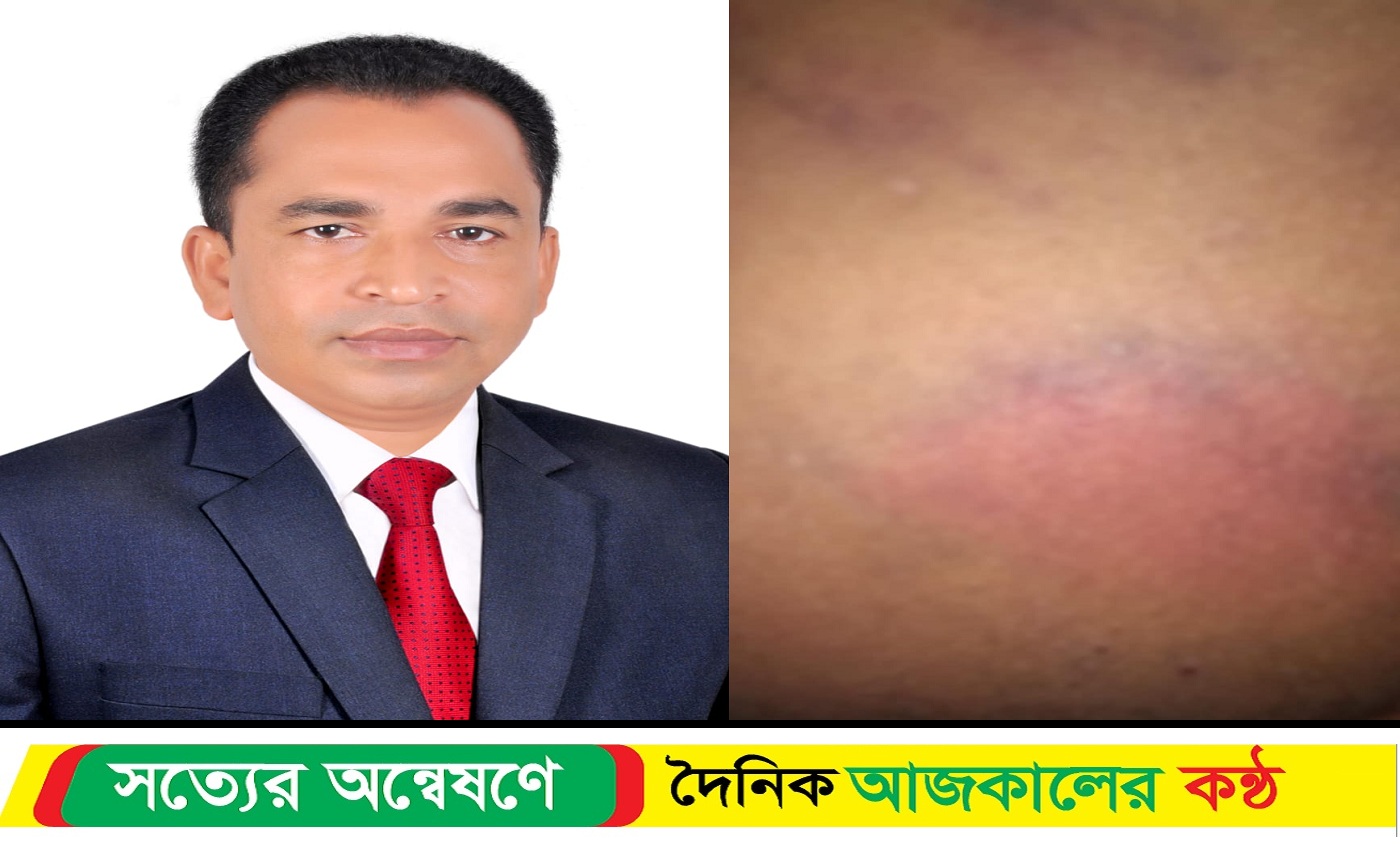 কুয়াকাটায় ব্যবসায়ীকে অ*পহরণ, অশ্লীল ভিডিও ধারণ করে অর্থ আদায়