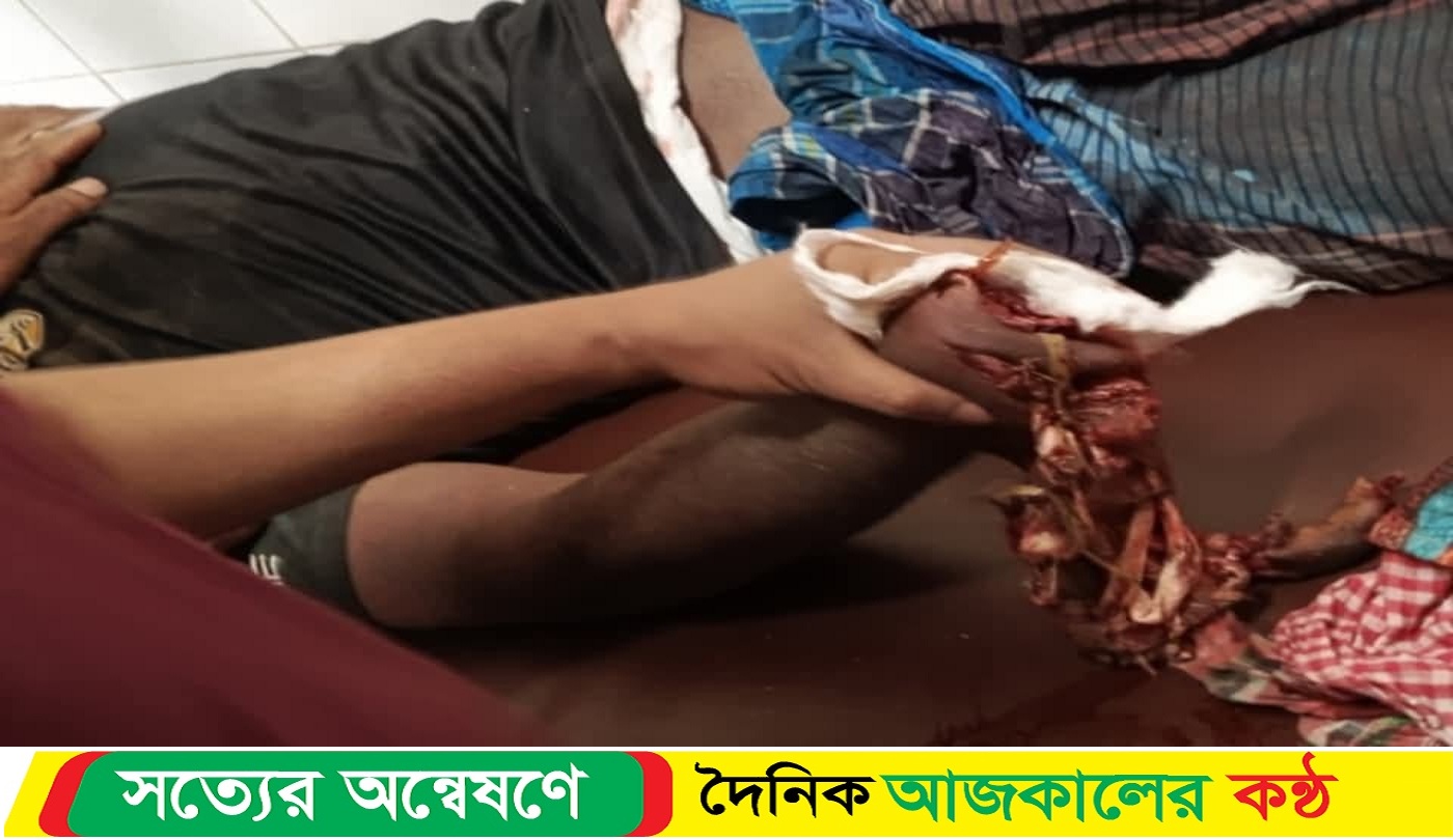 শরীয়তপুরের জাজিরায় বিলাসপুরের সংঘর্ষে শতাধিক হাতবোমার বি*স্ফোরণ, আ*হত ২০