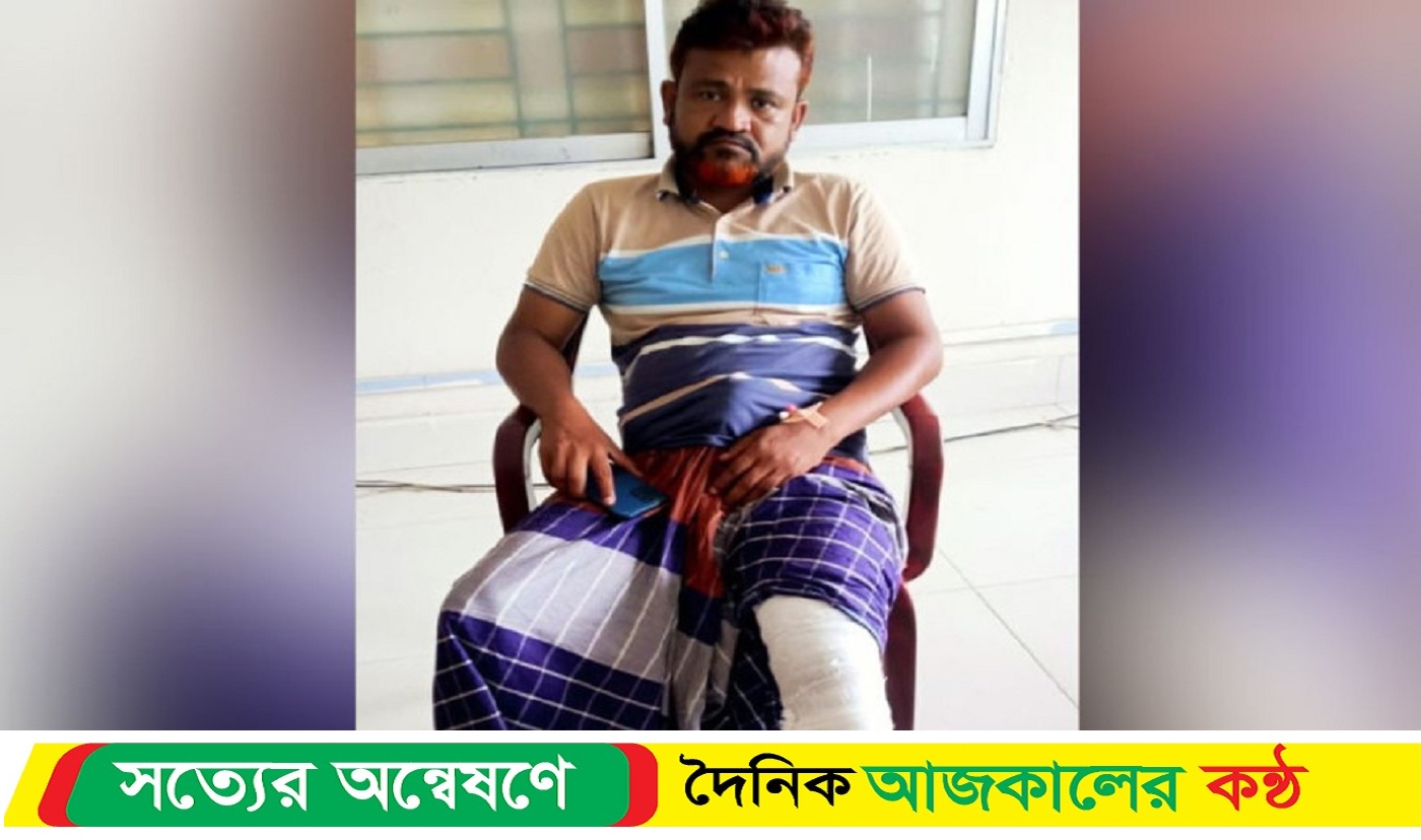 কোটচাঁদপুরে যুবদল সভাপতির পা ভেঙে দিয়েছে স*ন্ত্রাসীরা