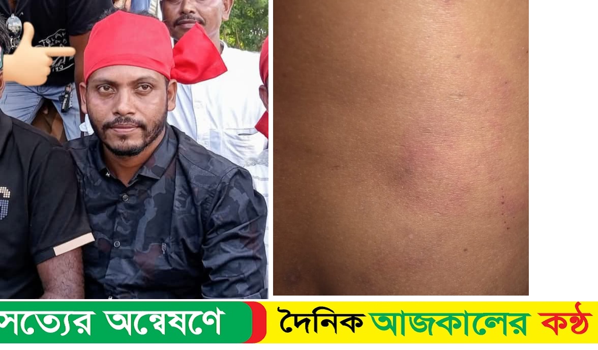 কুয়াকাটা ব্যবসায়ীকে মা*রধর, বি*বস্ত্র করে ভিডিও ধারণ, শ্রমিক দল নেতা গ্রে*ফতার