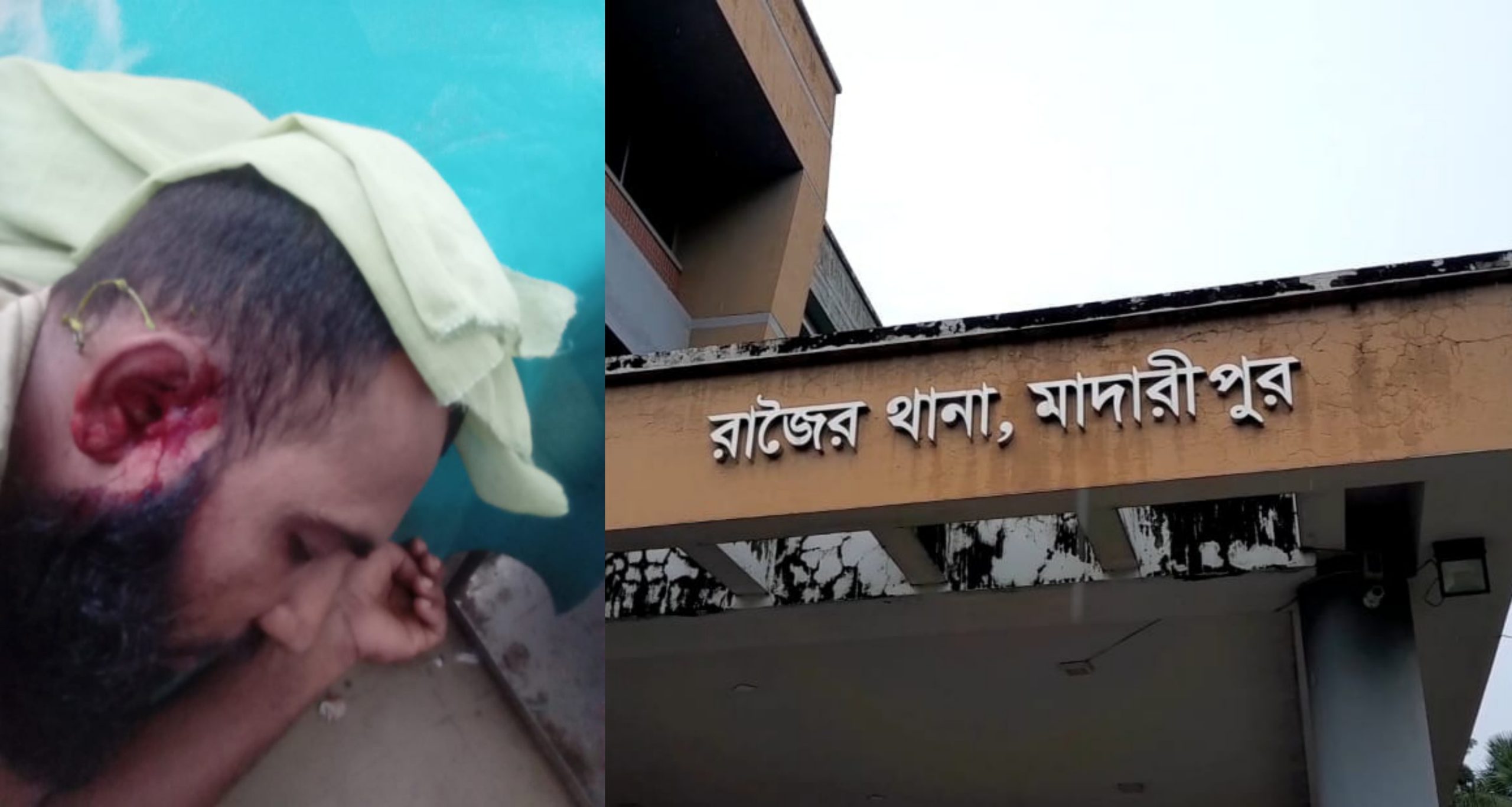 মাদারীপুরে মারধরের নালিশ করায় ঢাকা পোস্টের সাংবাদিকের ভাইকে কুপিয়ে জখম
