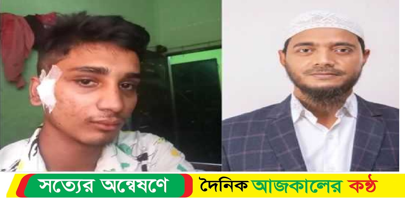 জুলাই আন্দোলনের হৃদয়ের মৃ*ত্যুতে গভীর শোক ড. মাসুদের