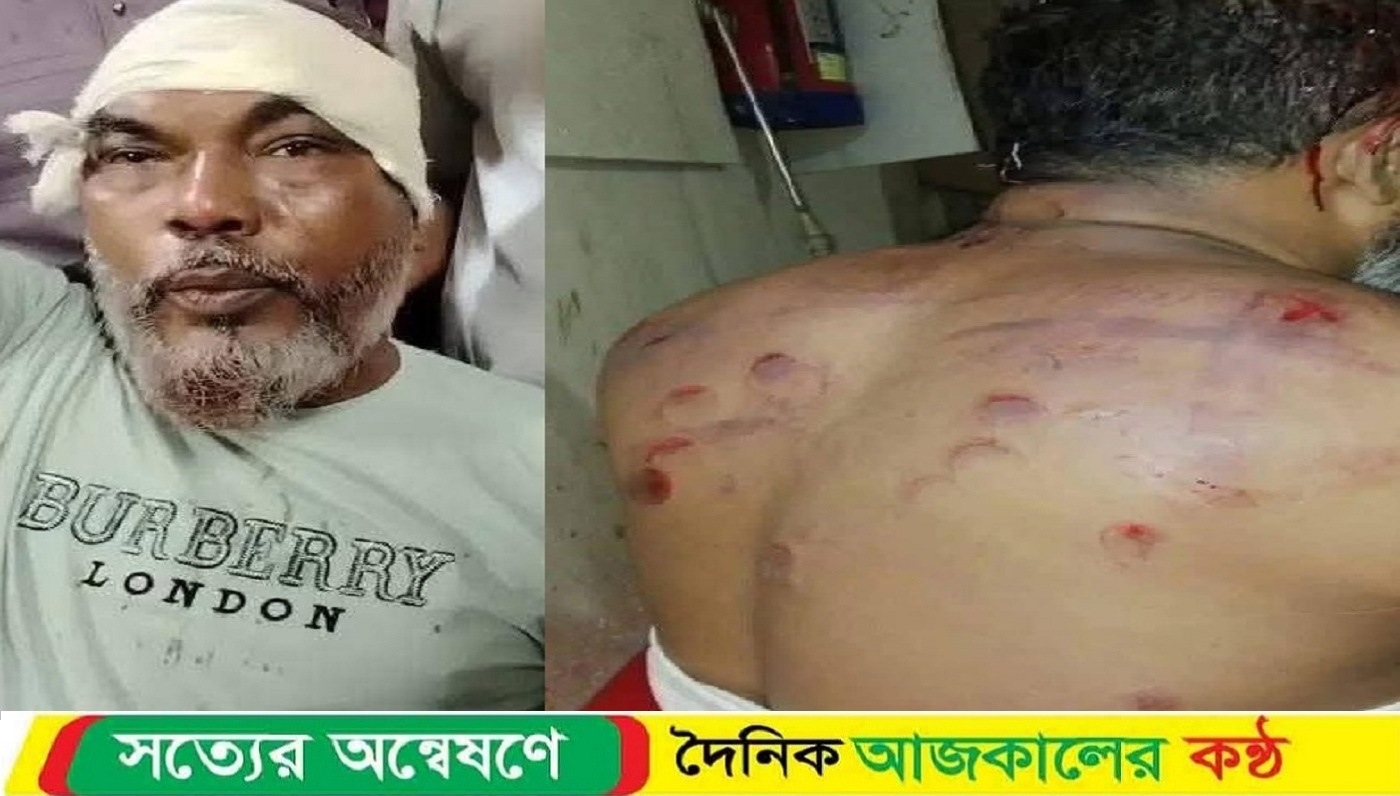 মিরসরাইয়ে বিএনপির প্রতিপেক্ষর হামলায় আহত সদস্য সচিবসহ নেতাকর্মীরা