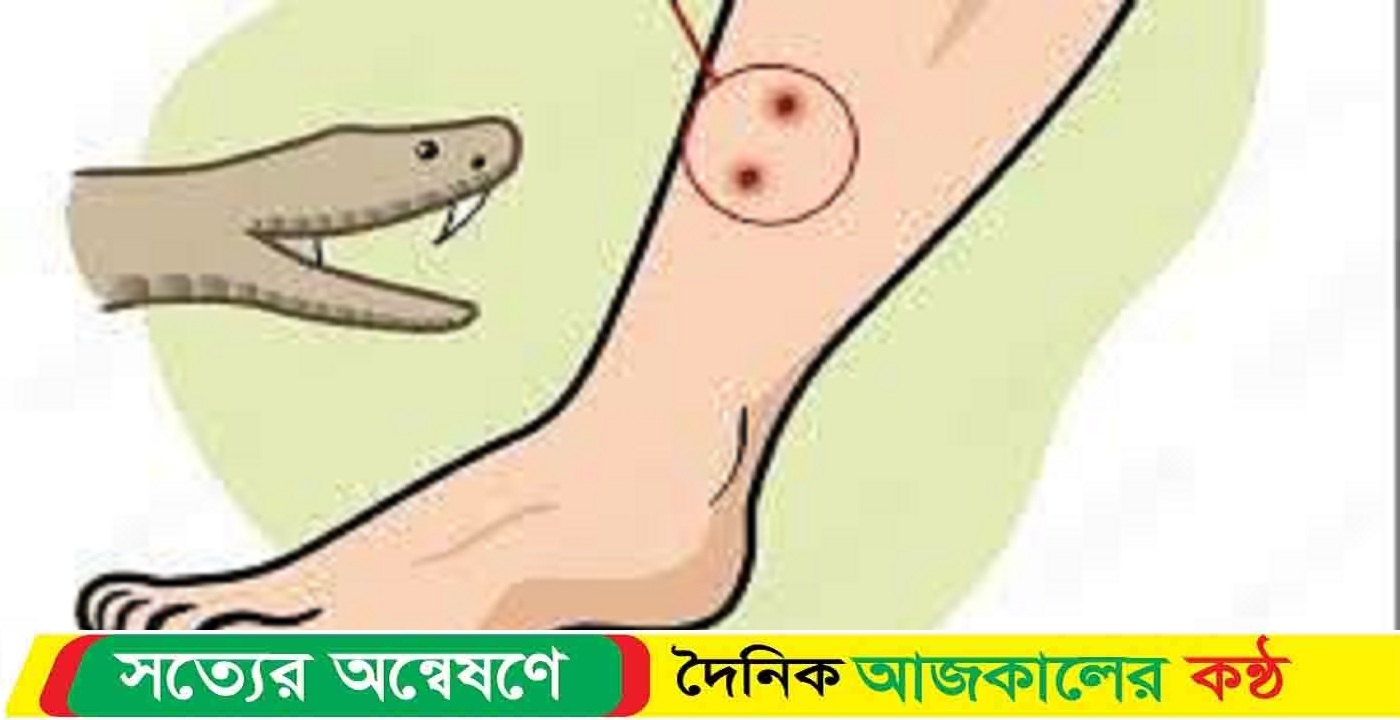 সন্দ্বীপে বিষধর সাপের কামড়ে আহত রিপন: চিকিৎসা অব্যবস্থাপনায় উদ্বেগ 
