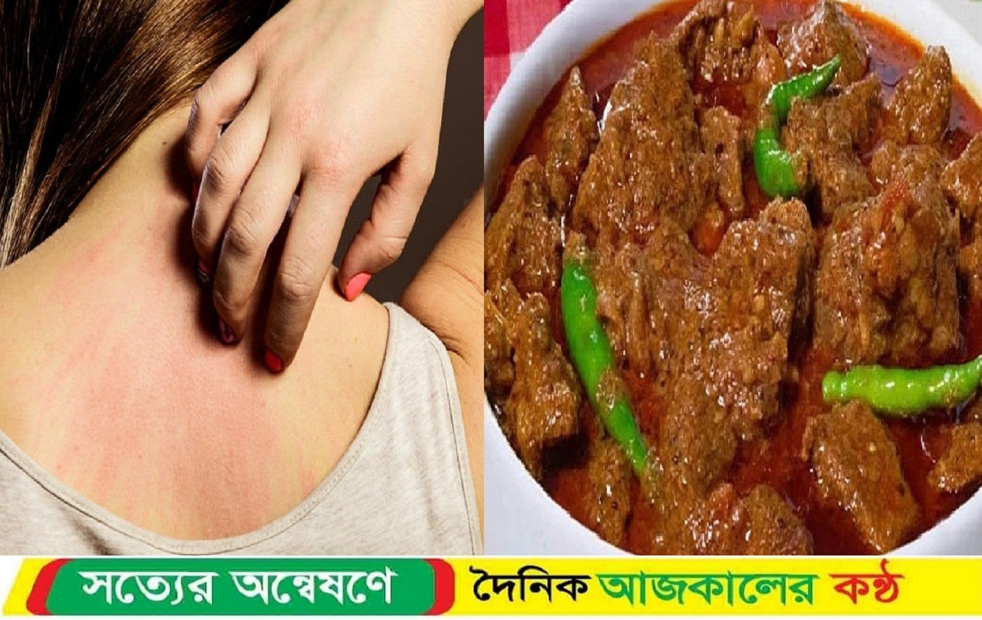 কীভাবে বুঝবেন মাংসে অ্যালার্জি আছে কিনা?
