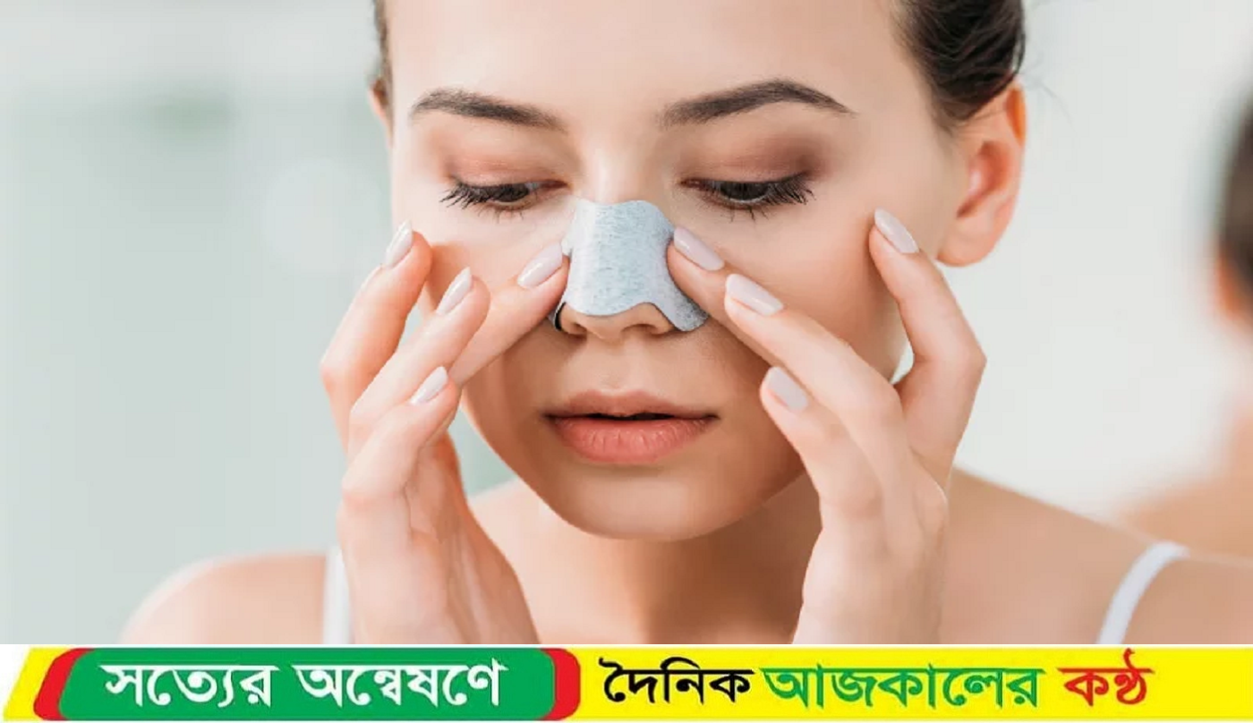 নাকের ব্ল্যাকহেডস ঘরোয়া উপায়েই মুক্তি পাবেন যেভাবে