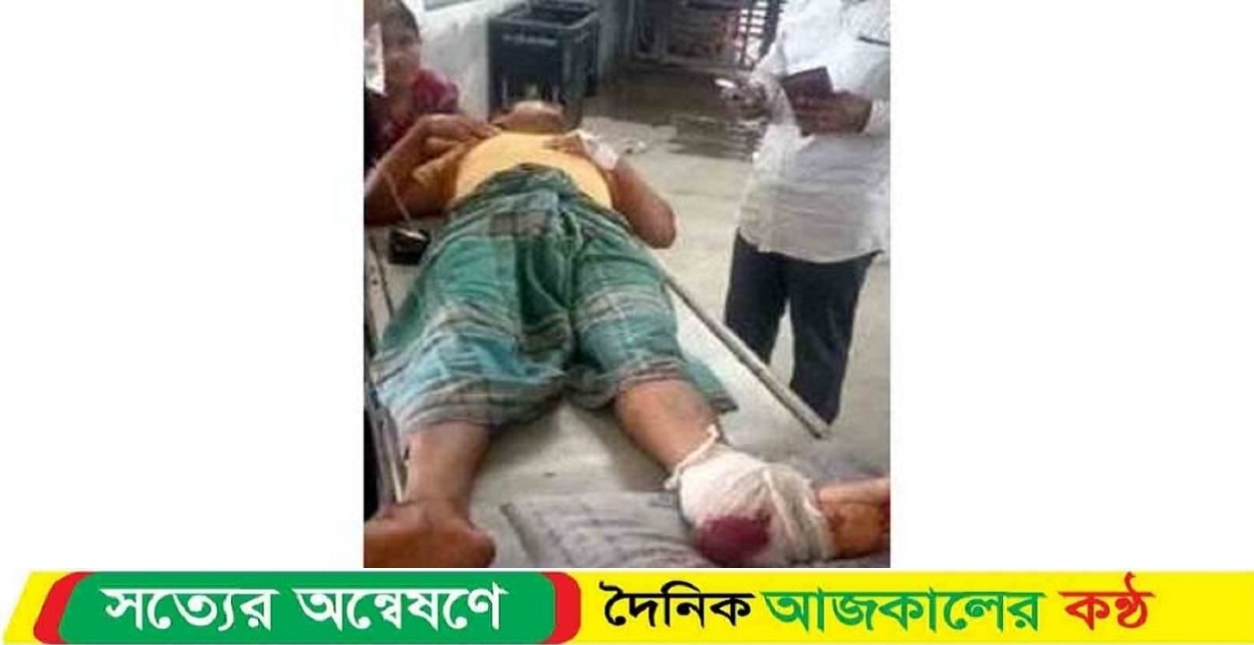 কাঠালিয়ায় গভীর রাতে ঘরের সিদ কেটে এনজিও কর্মীর ওপর হামলা, ধারালো অস্ত্রের কোপে পায়ের গোড়ালি বিচ্ছিন্ন