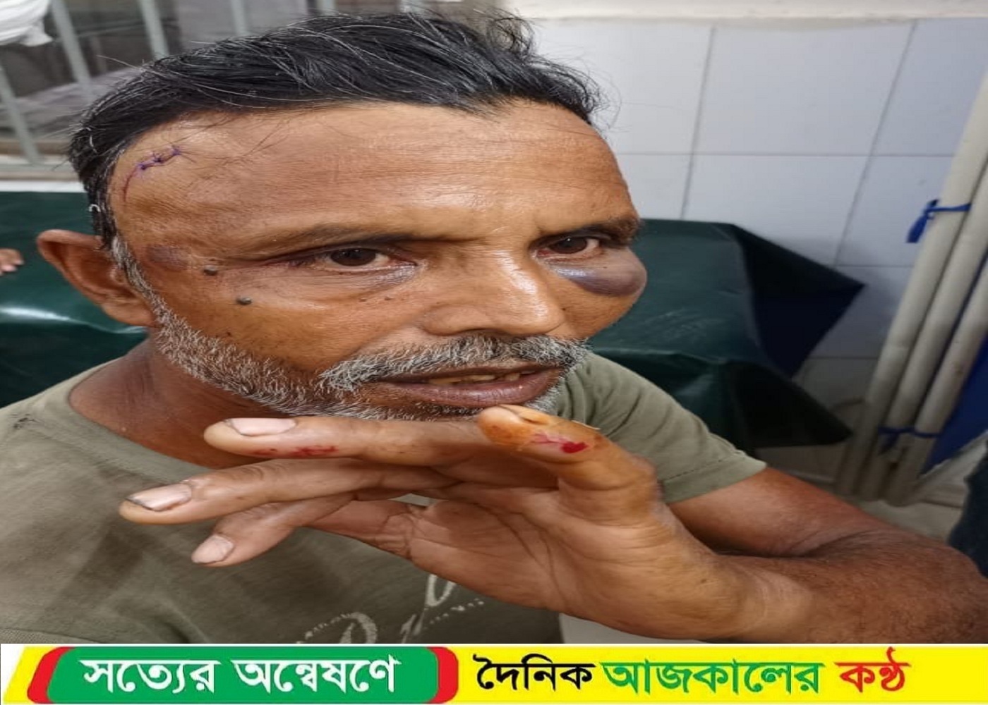 লেনদেন সম্পর্কিত আপোষ মিমাংসার বিচারে মারধরের অভিযোগ