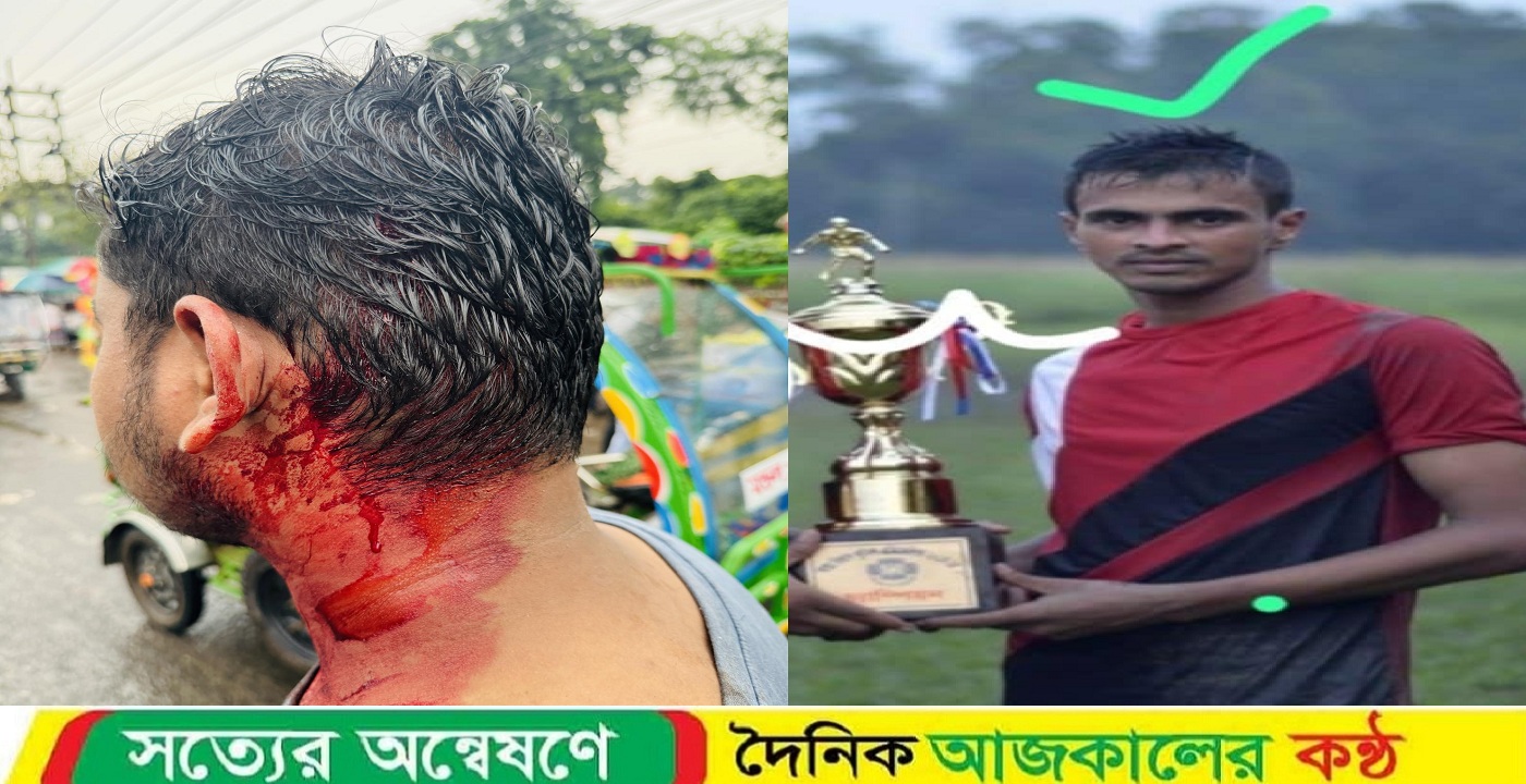 অন্যায়ের প্রতিবাদ করায় ছাত্রদল কর্মী কর্তৃক আক্রমণের শিকার জাবি শিক্ষার্থী