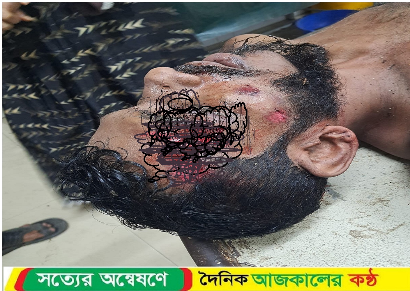 মতলব উত্তরে অটোরিকশা চালককে কুপিয়ে ও গুলি করে হত্যা