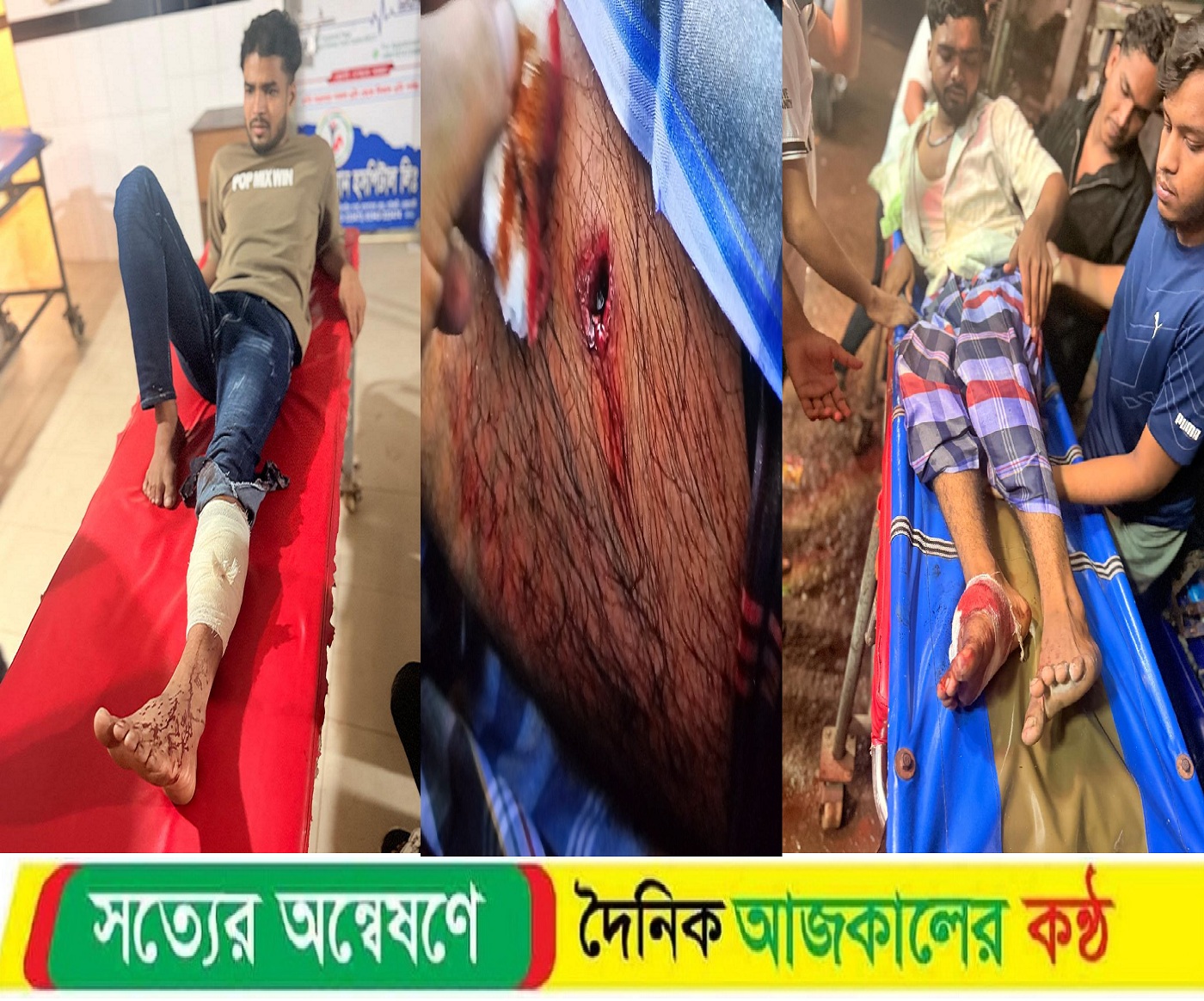 বেগমগঞ্জে যুবদল কর্মির গুলিতে জামায়াতের ২কর্মি গুলিবিদ্ধ