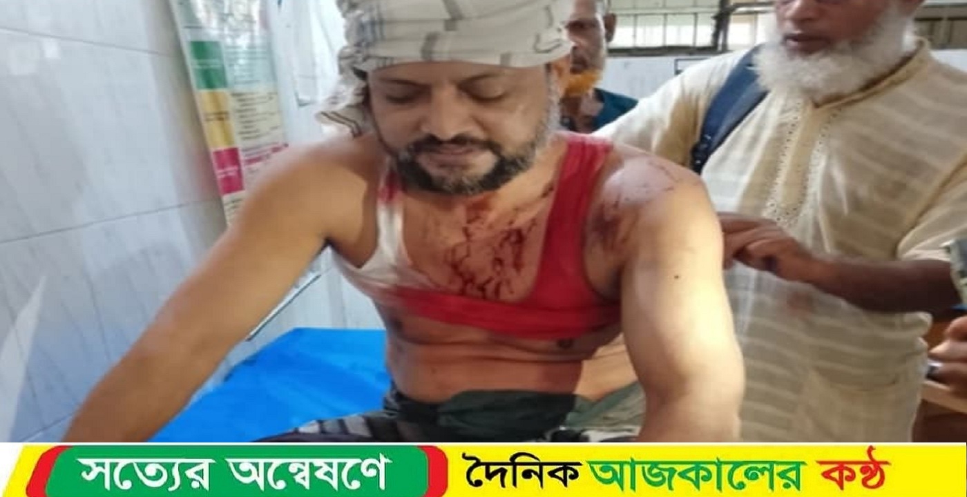 ইন্দুরকানীতে চুরির ব্যাপারে সন্দেহ করায় ক্ষিপ্ত হয়ে সন্দেহকারীদের হামলায় আহত ১