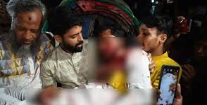 জাতীয় পার্টির কার্যালয়ের সামনে সংঘর্ষে গুরুতর আহত নুর