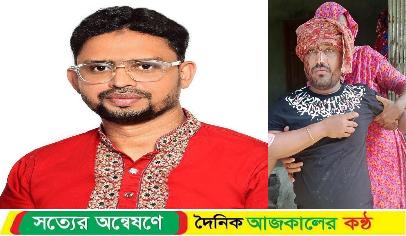স্বেচ্ছাসেবক দলের নেতাকে কোপানোর ঘটনায় গণঅধিকার পরিষদ নেতার বিরুদ্ধে মামলা