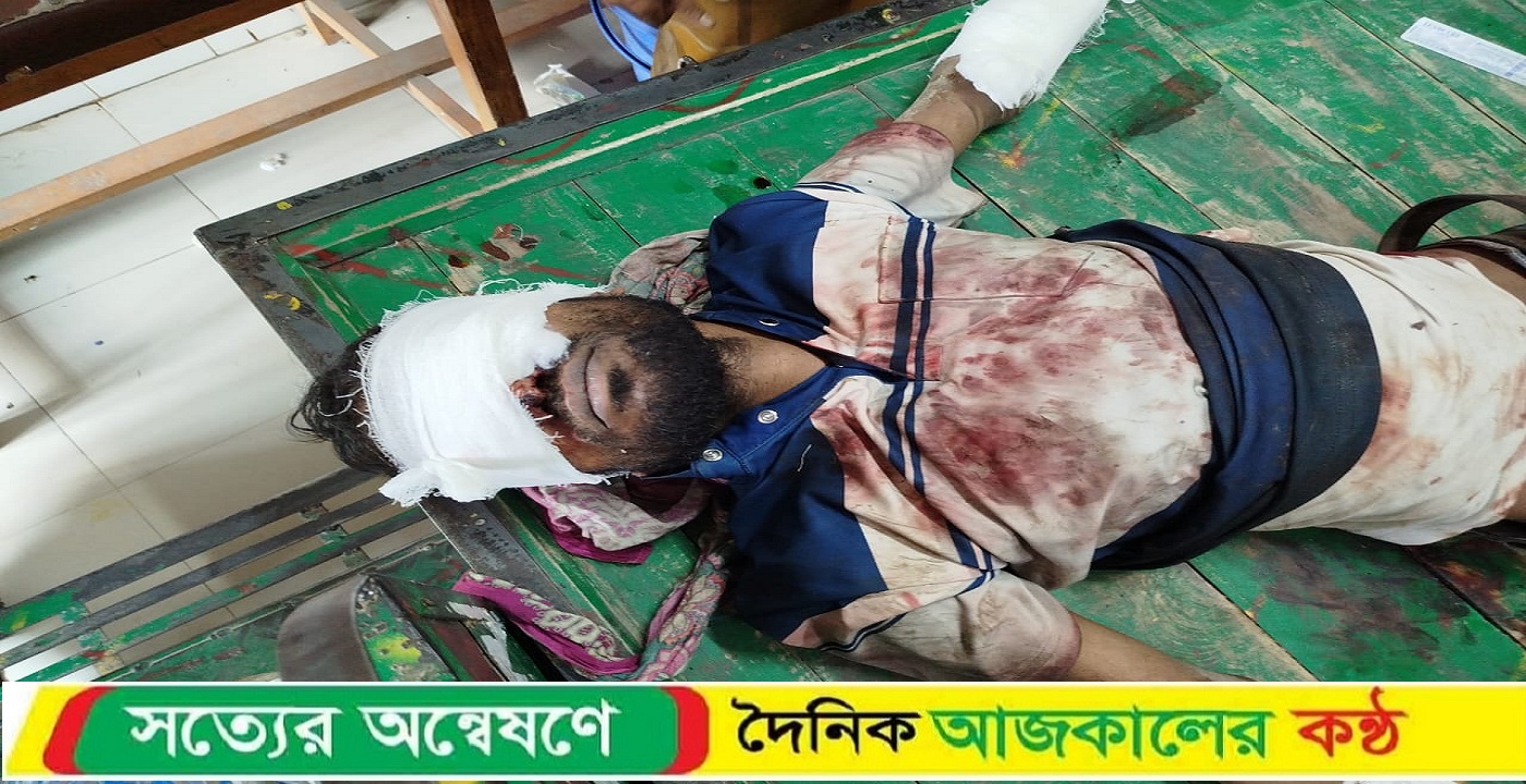 জাজিরায় মাদক ব্যাবসায়ী দ্বারা চোঁখ এবং হাত-পায়ের রগ কেটে ফেলার অভিযোগ