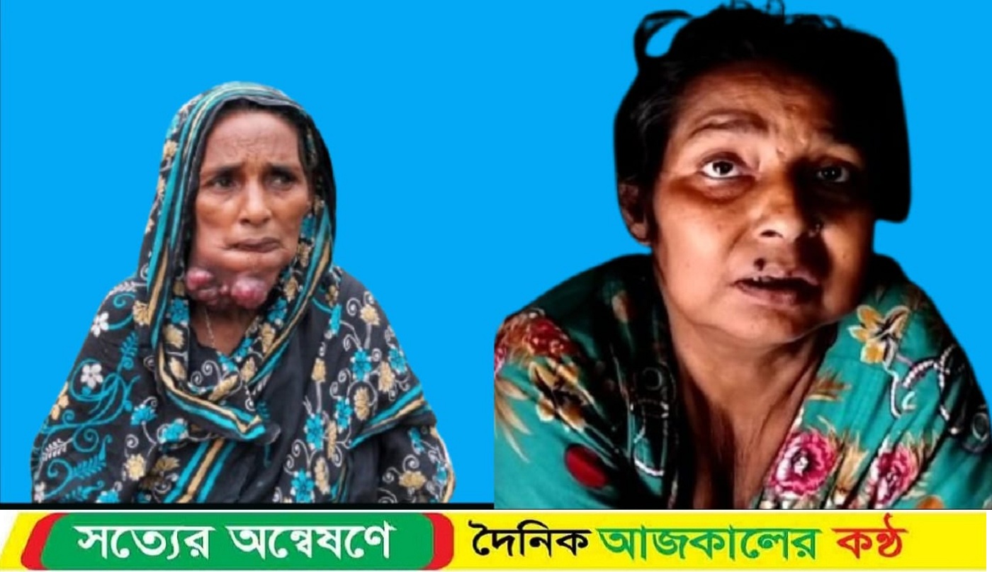 মধ্যনগরে ভাঙা জরাজীর্ণ কুঁড়েঘরে মা–মেয়ের দুর্দশাজনিত জীবন