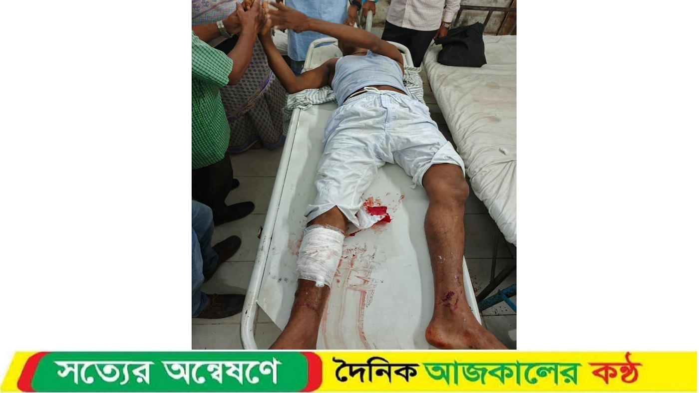 পিরোজপুরে প্রধান শিক্ষককে হাতুড়ি পেটা করে হাত-পা ভেঙে দিয়েছে দুর্বৃত্তরা