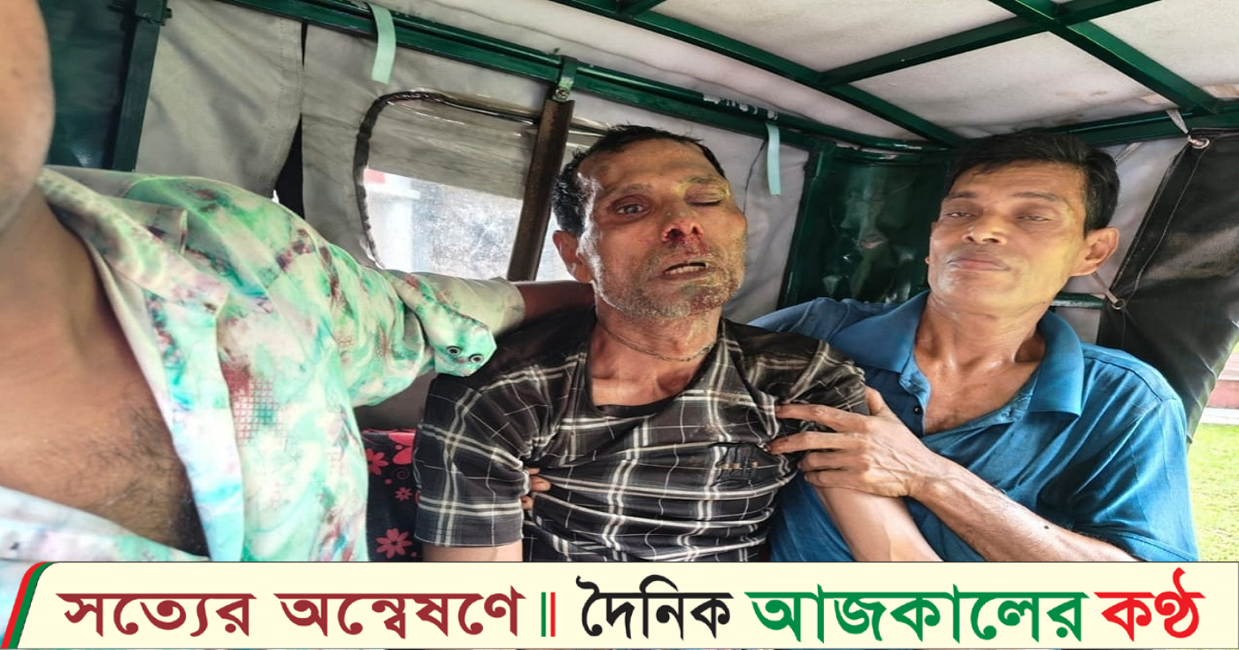 ইন্দুরকানীতে সুপারি পাড়াকে কেন্দ্র করে ভাতিজার দায়ের কোপে চাচা গুরতর আহত