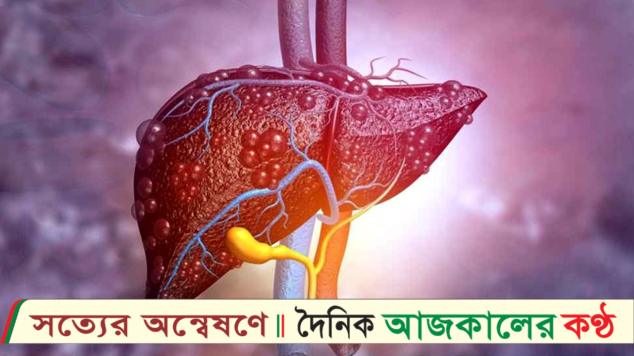 পেট ও পায়ে ফোলাভাব : লিভার সমস্যার পূর্বাভাস?