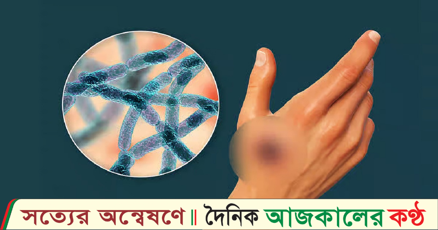 মুরাদনগরে অ্যানথ্রাক্স আতঙ্ক: গবাদিপশুর মধ্যে সংক্রমণ