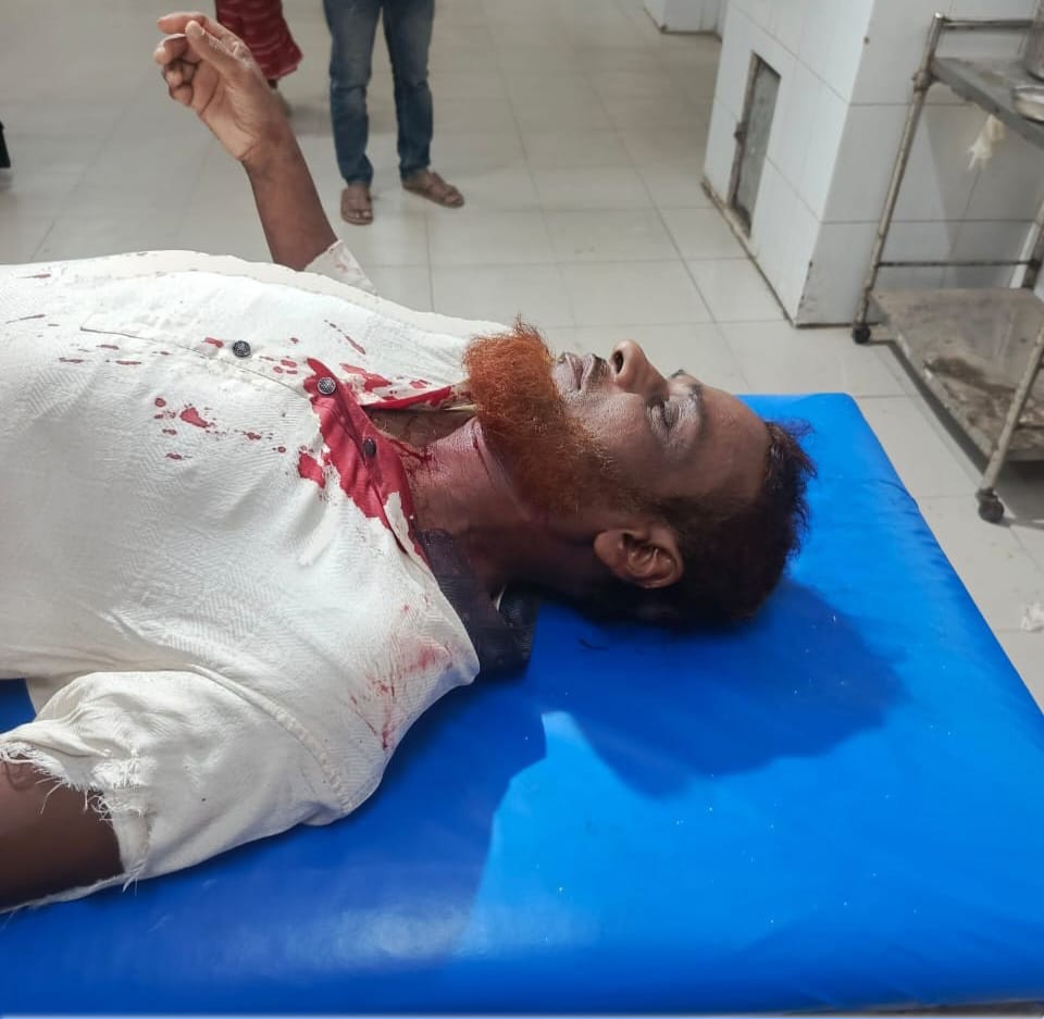 আমতলীতে ব্যবসায়ীকে হাতুড়ি পেটা করে টাকা ছিনতাই