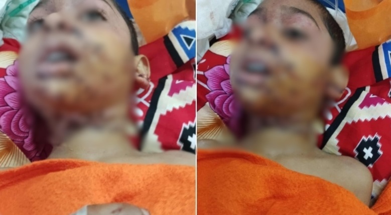 নাটোরে সম্পত্তির লোভে পাঁচ বছরের শিশুকে হত্যার চেষ্টা: ভাবি গ্রেফতার