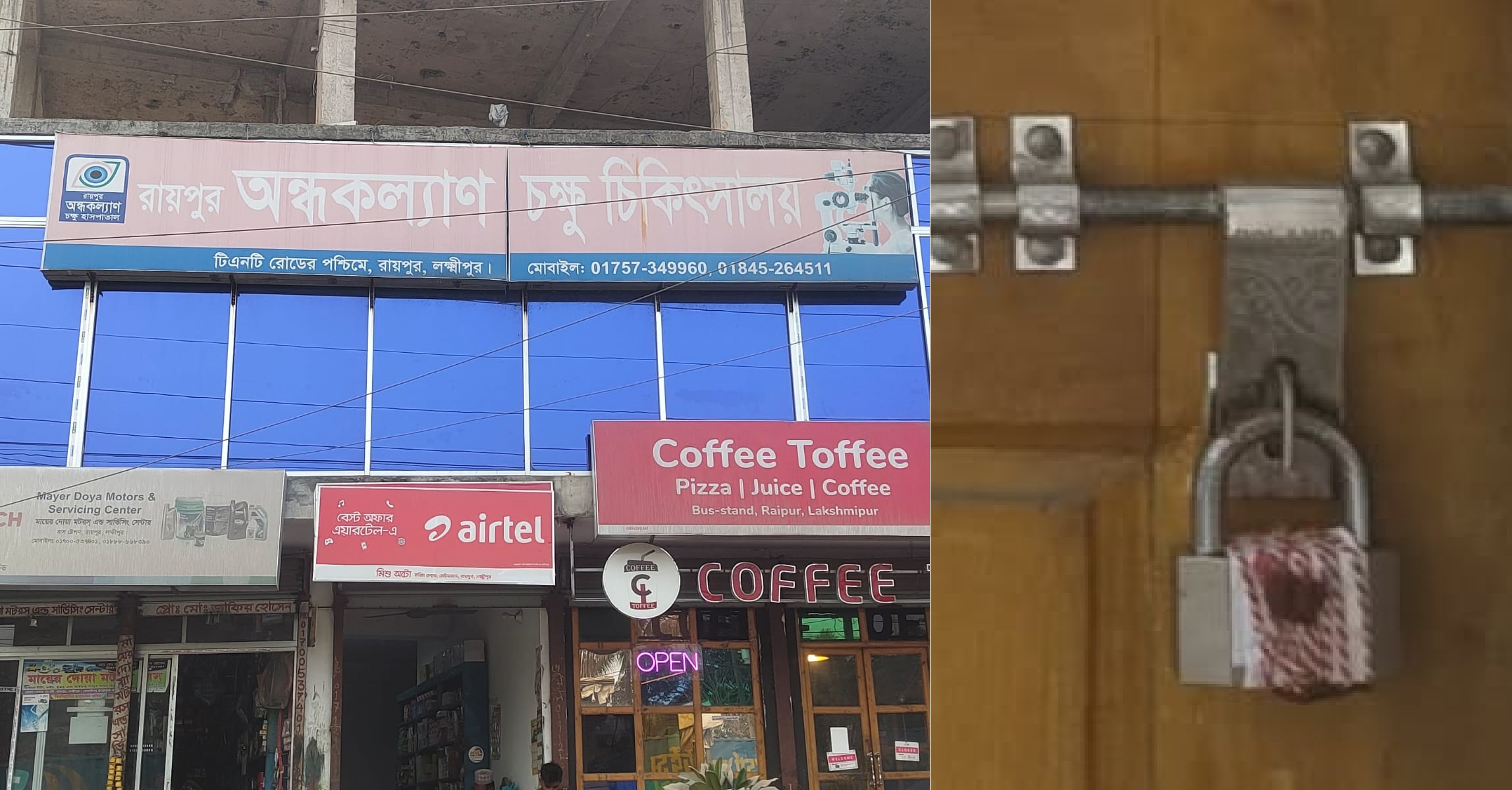 রোগীর চোখ নিয়ে ব্যবসা: রায়পুরে তিনটি চক্ষু হাসপাতাল সিলগালা