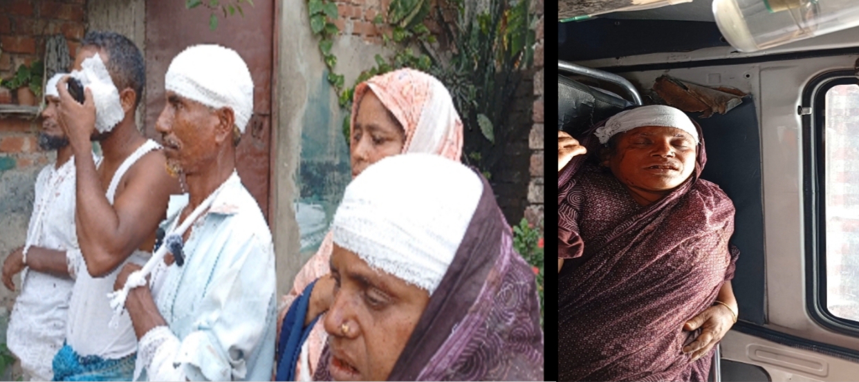 মিরসরাইয়ে সালিশী বৈঠকে প্রতিপক্ষের ককটেল নিক্ষেপ ও হামলায় নারীসহ ৮ জন আহত
