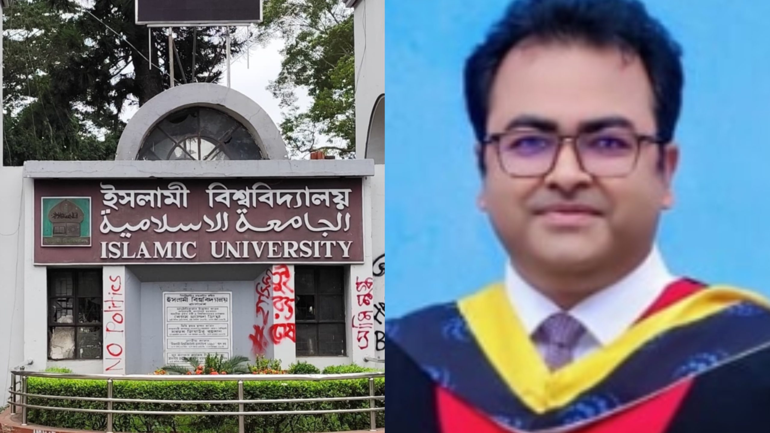 মাঙ্কিপক্স শনাক্তে কৃত্রিম বুদ্ধিমত্তা: গবেষণায় আন্তর্জাতিক স্বীকৃতি পেলেন ইবি গবেষক
