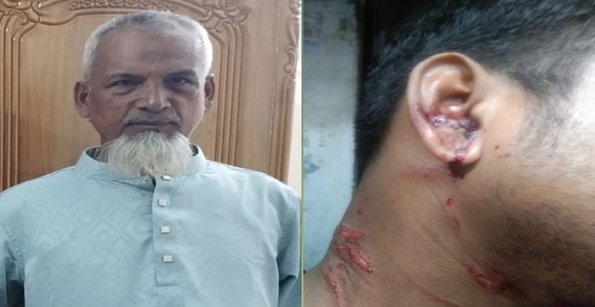 সাতক্ষীরায় পৈতৃক সম্পত্তি নিয়ে বিরোধের জেরে হামলার অভিযোগ, আহত ৩