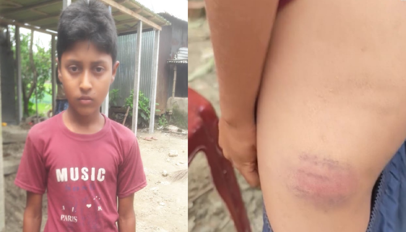 সরিষাবাড়ীতে মাদ্রাসা শিক্ষার্থীকে নির্যাতনের অভিযোগ, শিক্ষকের বিরুদ্ধে ক্ষোভ