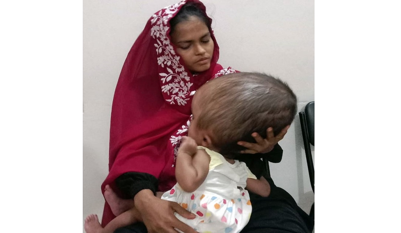 দুই বছরের শিশুর মাথার ওজন ১২ কেজি
