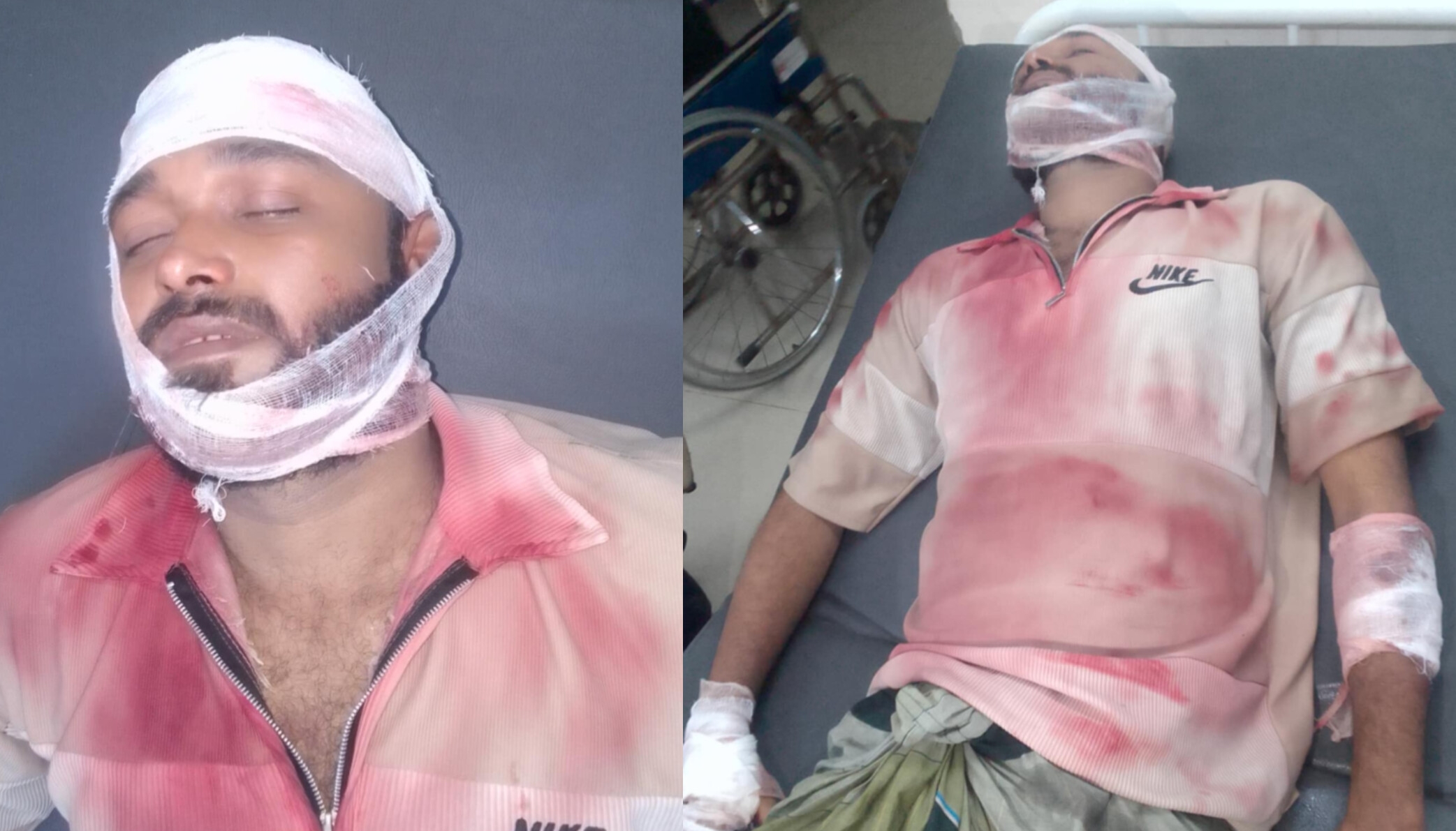 মিরসরাইয়ে মিঠাছড়া ব্যাটারি চুরি কেন্দ্র করে সংঘর্ষ মধ্যস্থতা করতে গিয়ে যুবদল কর্মীকে কুপিয়ে জখম, বাইকে আগুন