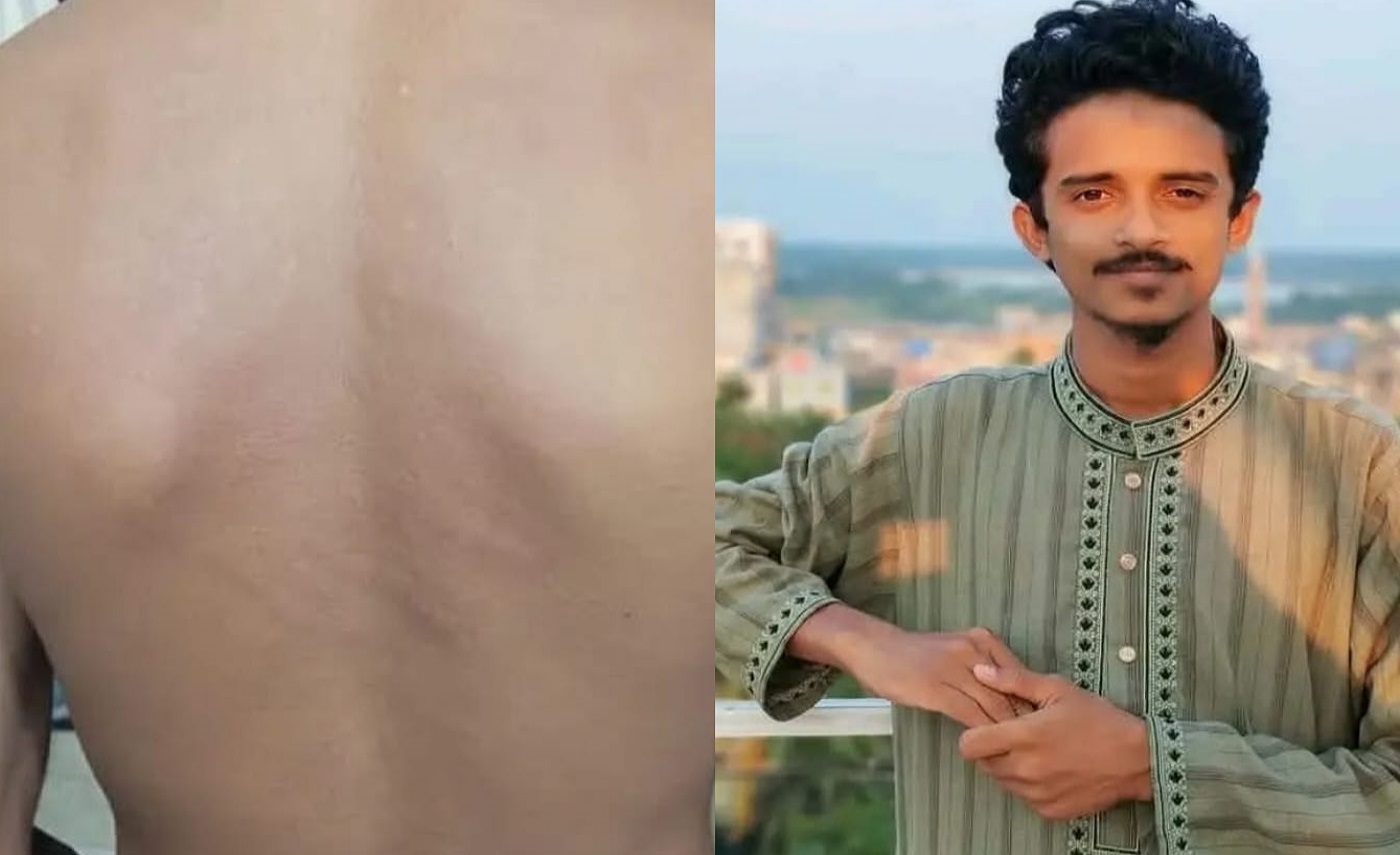 শিবির করায় ববির এক চুক্তিভিত্তিক কর্মচারীকে ছাত্রদলের মারধর, অতঃপর চাকরিচ্যুত