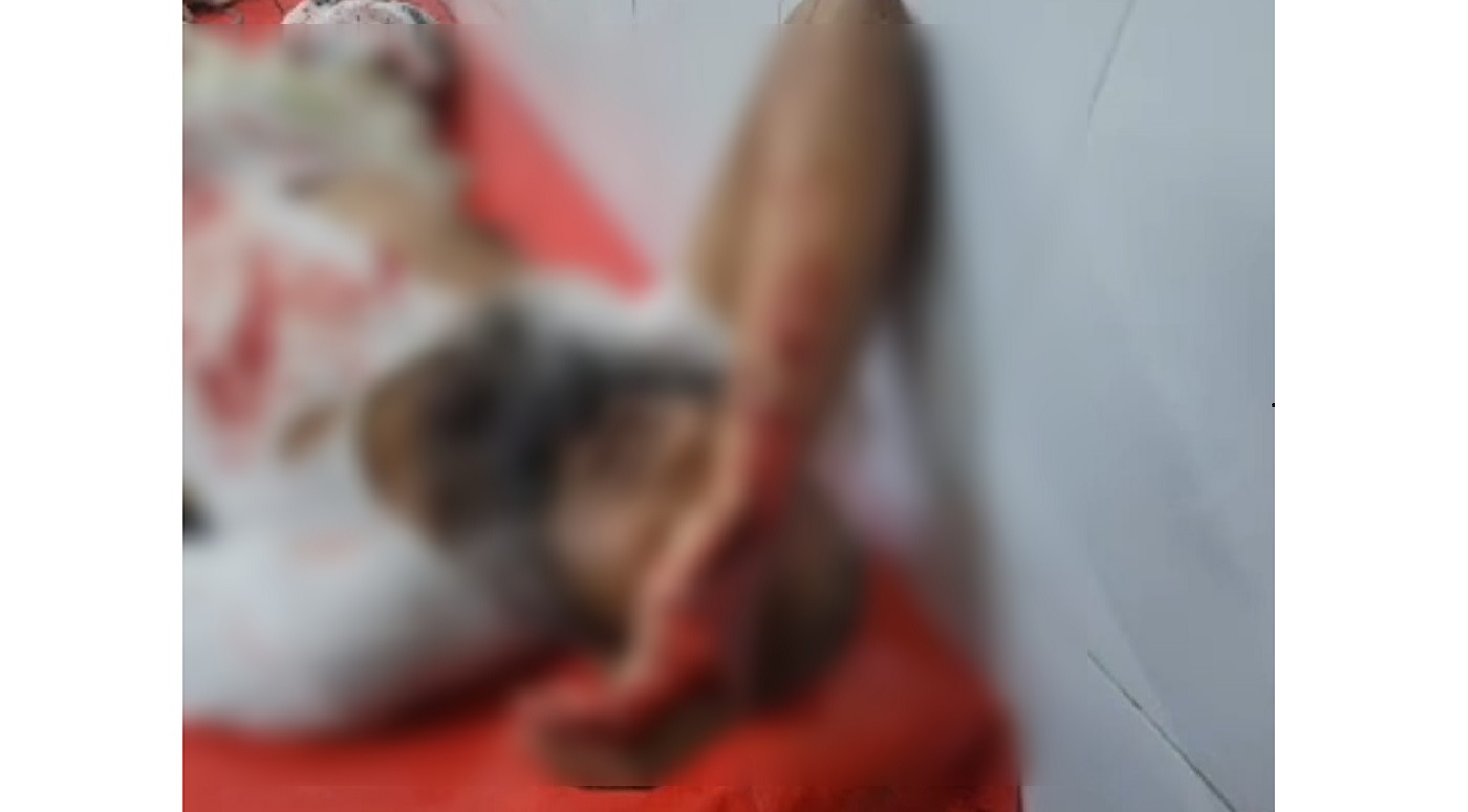 তারাগঞ্জে ব্যবসায়ীকে কুপিয়ে জখম, আশঙ্কাজনক অবস্থায় রংপুরে ভর্তি