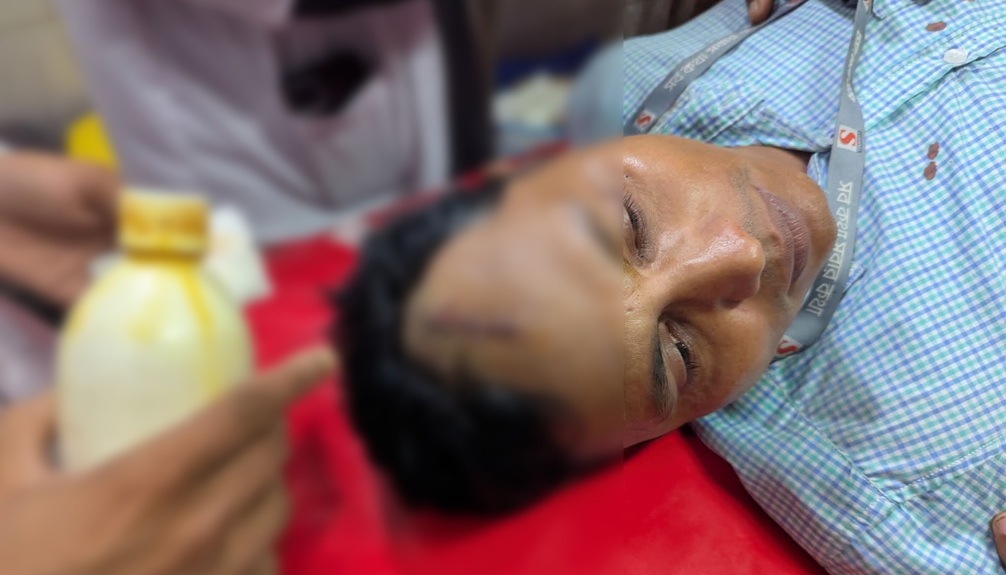 কালিয়াকৈরে সংবাদ সংগ্রহ করতে গিয়ে অতর্কিত হামলার শিকার দুই সাংবাদিক