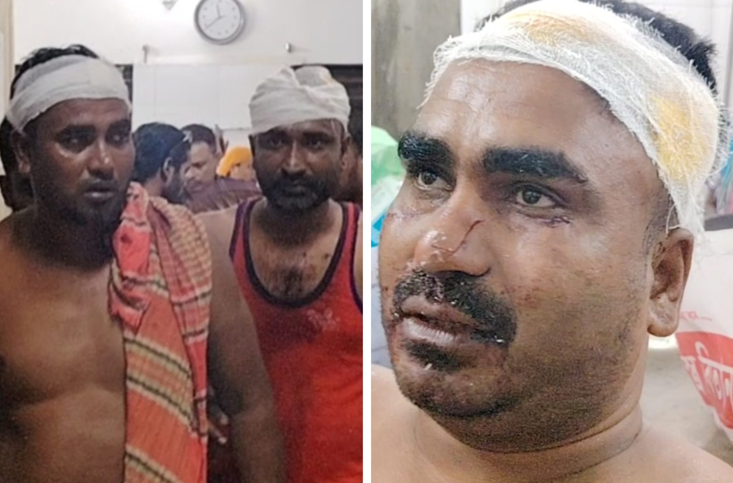 লোহাগড়ায় মাদক বিক্রিতে বাধা দেওয়াকে কেন্দ্র করে আওয়ামী লীগ নেতার নেতৃত্বে আপন ৩ ভাইকে কুপিয়ে জখম